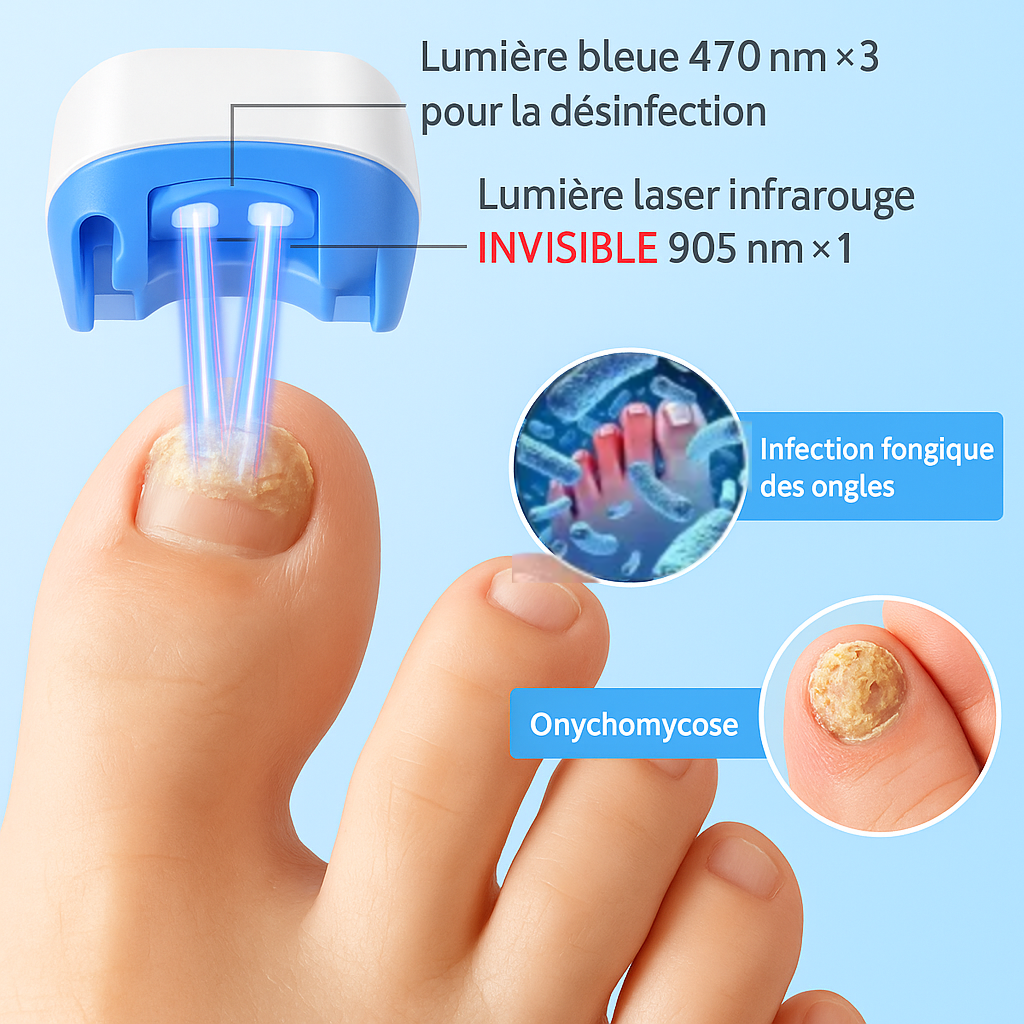 Appareil Anti-Mycose Ongles - Traitement Photothérapeutique par LED & Infrarouge