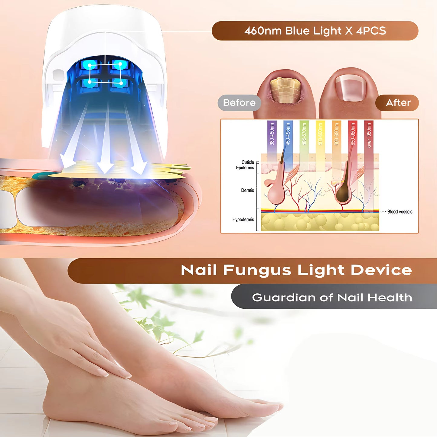 Appareil Anti-Mycose Ongles - Traitement Photothérapeutique par LED & Infrarouge